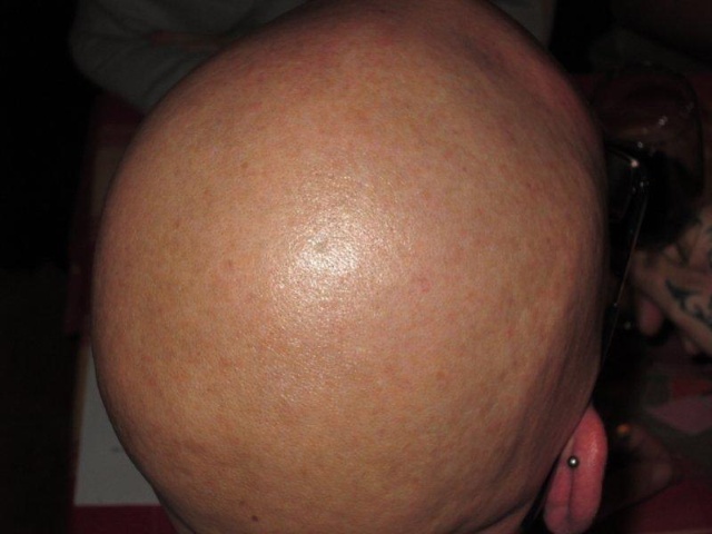 IMG 0187